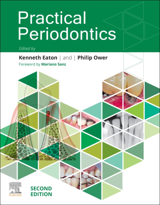 E-knjiga Practical Periodontics - E-Book Kenneth A Eaton