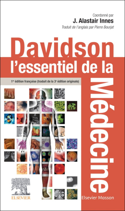 E-knjiga Davidson : l'essentiel de la medecine J. Alastair Innes