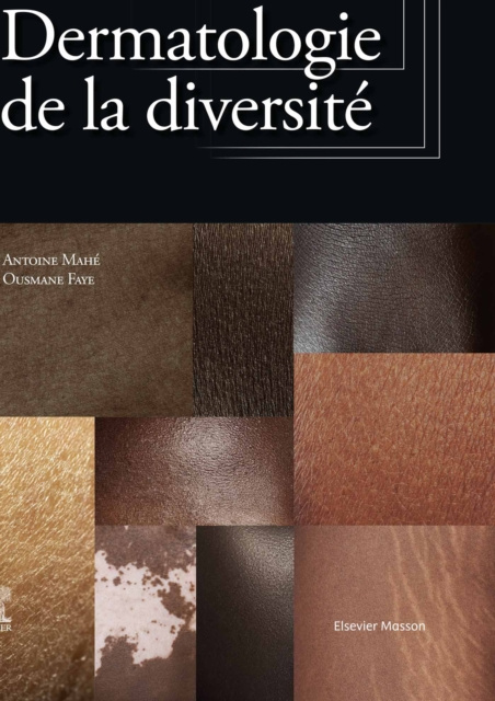 E-kniha Dermatologie de la diversite Antoine Mahe