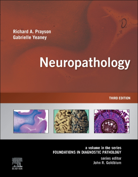 E-kniha Neuropathology E-Book Richard A. Prayson