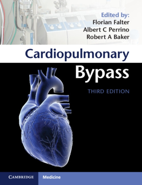 E-kniha Cardiopulmonary Bypass Florian Falter