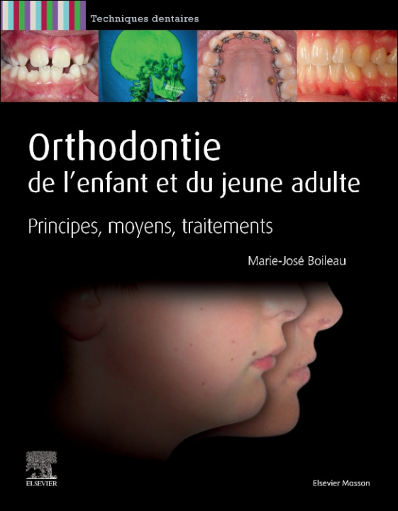 E-kniha Orthodontie de l'enfant et du jeune adulte Marie-Jose Boileau