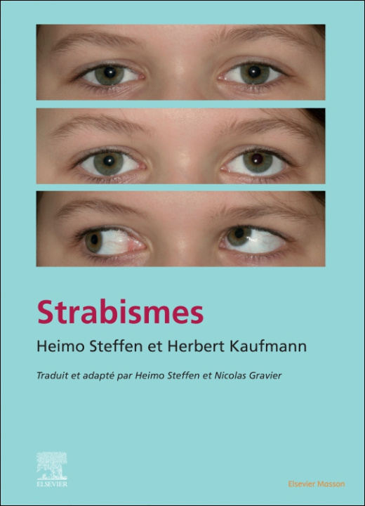 E-book Strabisme Nicolas Gravier