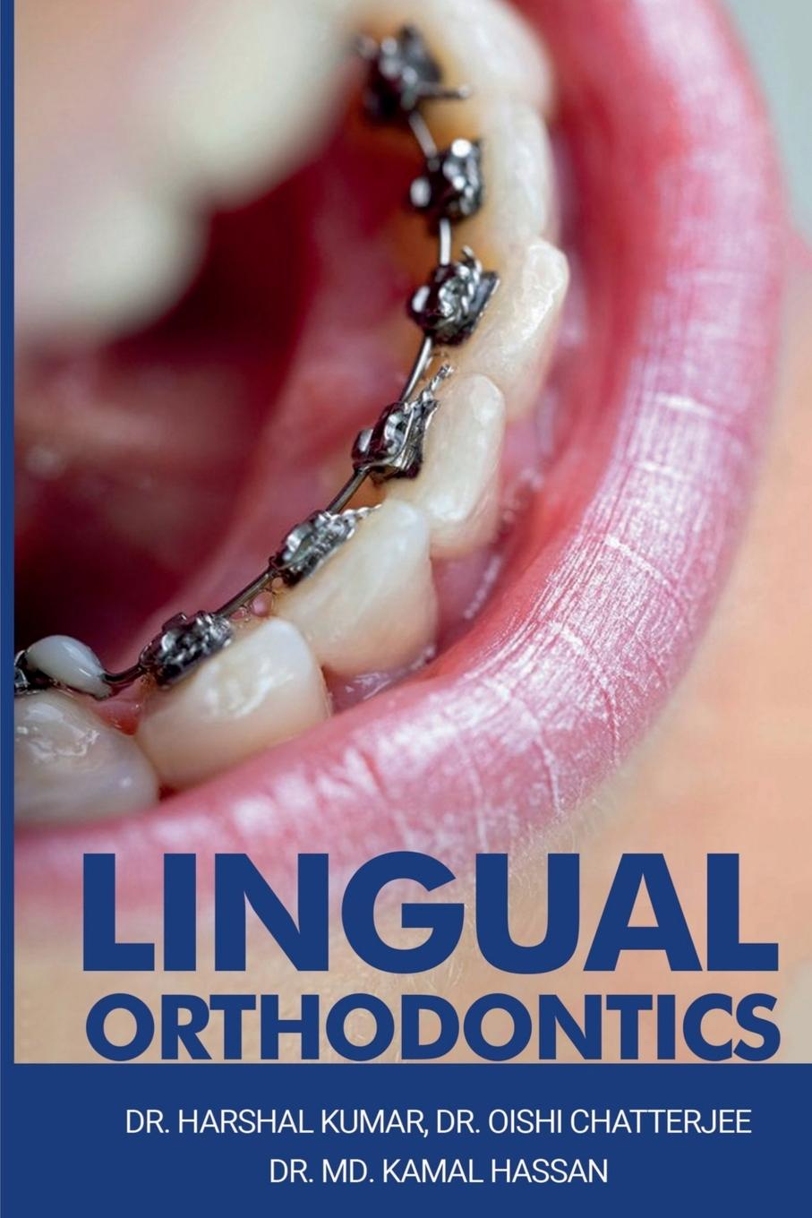 Book Lingual Orthodontics Kumar Harshal