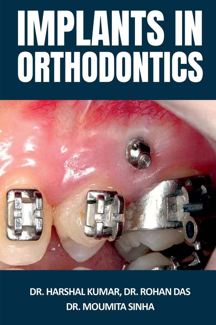 Книга Implants in Orthodontics 