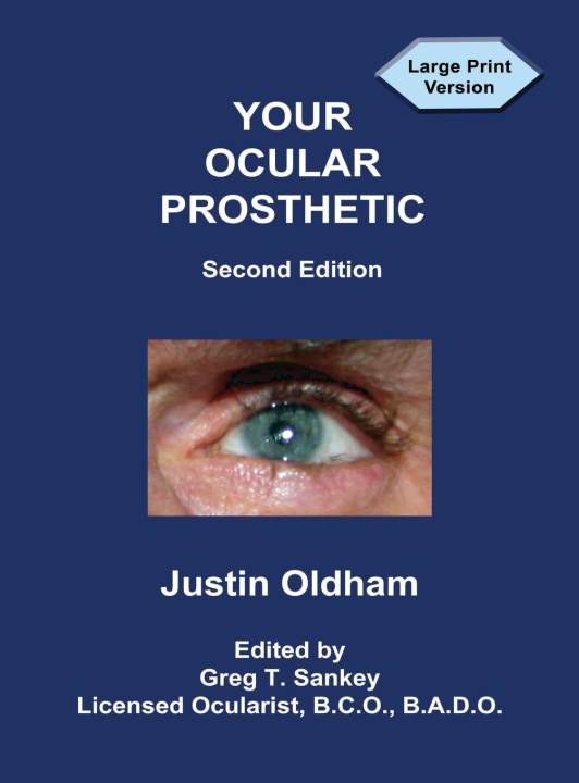 Book Your Ocular Prosthetic Greg T. Sankey