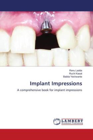 Könyv Implant Impressions Ruchi Kasat
