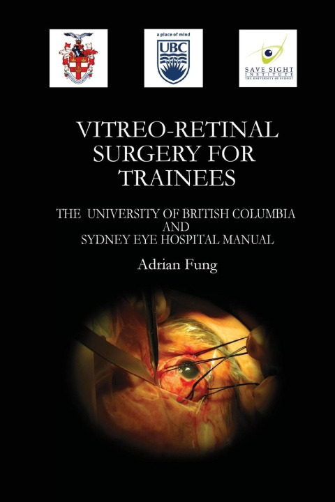 Book Vitreoretinal Surgery for Trainees- The University of British Columbia and Sydney Eye Hospital Manual 