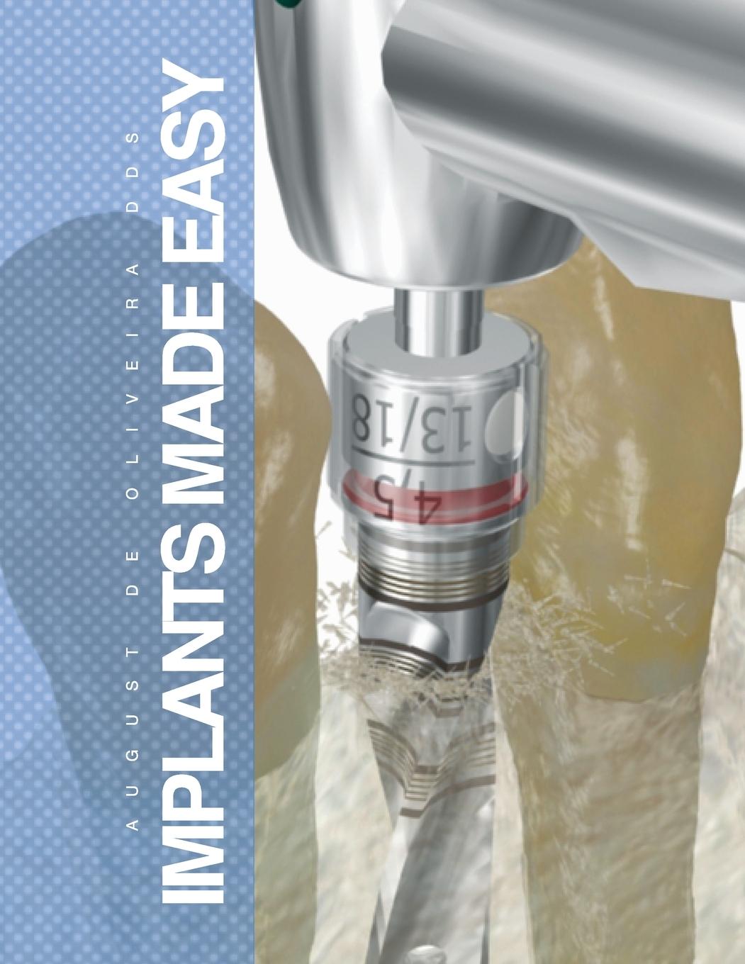 Knjiga Implants Made Easy August de Oliveira