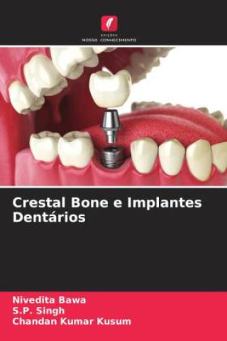 Kniha Crestal Bone e Implantes Dentários S. P. Singh