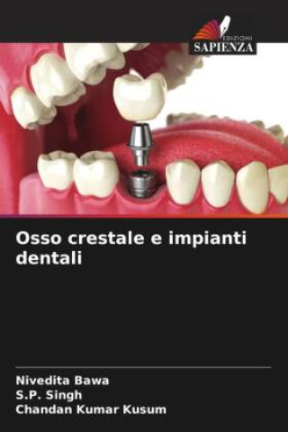 Kniha Osso crestale e impianti dentali S. P. Singh