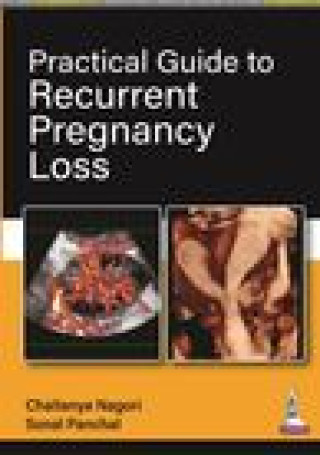 Knjiga Practical Guide to Recurrent Pregnancy Loss Sonal Panchal