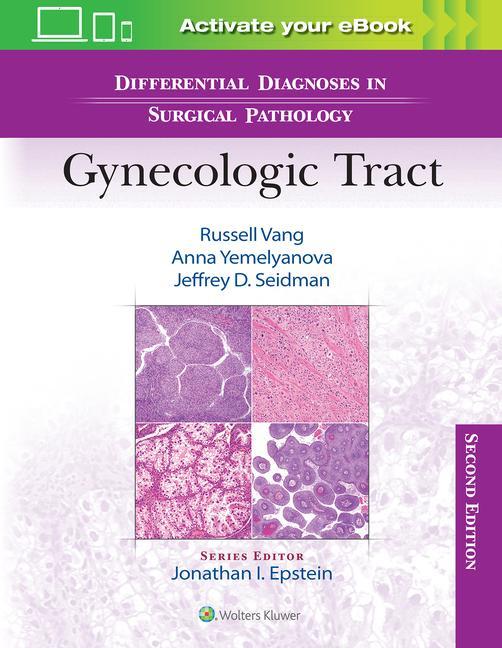 Könyv Differential Diagnoses in Surgical Pathology: Gynecologic Tract Russell Vang