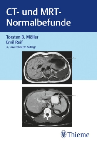 Kniha CT und MRT Normalbefunde Emil Reif