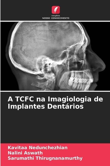 Knjiga A TCFC na Imagiologia de Implantes Dentários Nalini Aswath