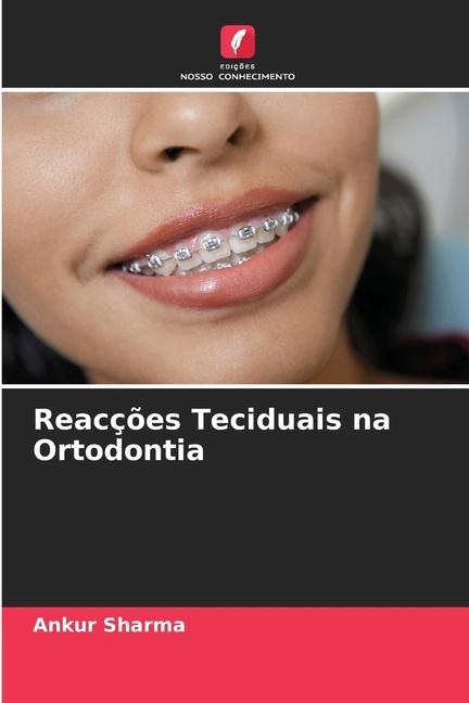 Knjiga Reacç?es Teciduais na Ortodontia Ankur Sharma
