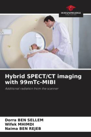 Könyv Hybrid SPECT/CT imaging with 99mTc-MIBI Wifek Mhimdi
