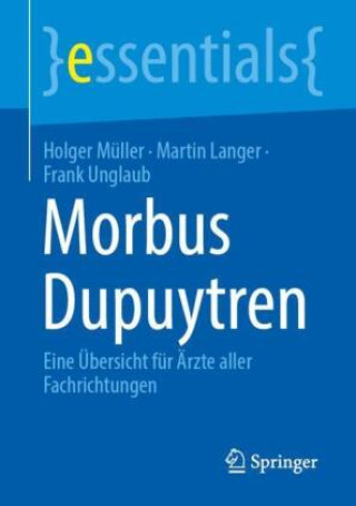 Kniha Morbus Dupuytren Holger Müller