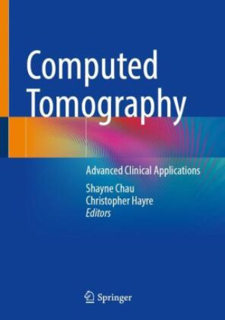 Book Computed Tomography Shayne Chau