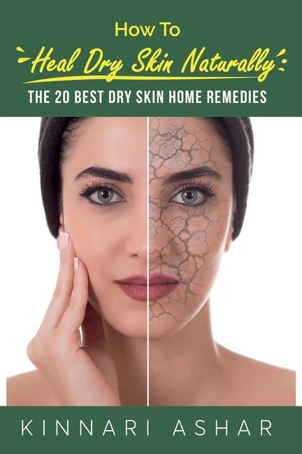 Kniha How to Heal Dry Skin Naturally: The 20 Best Dry Skin Home Remedies Neil Germio