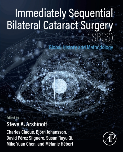 E-kniha Immediately Sequential Bilateral Cataract Surgery (ISBCS) Steve A. Arshinoff