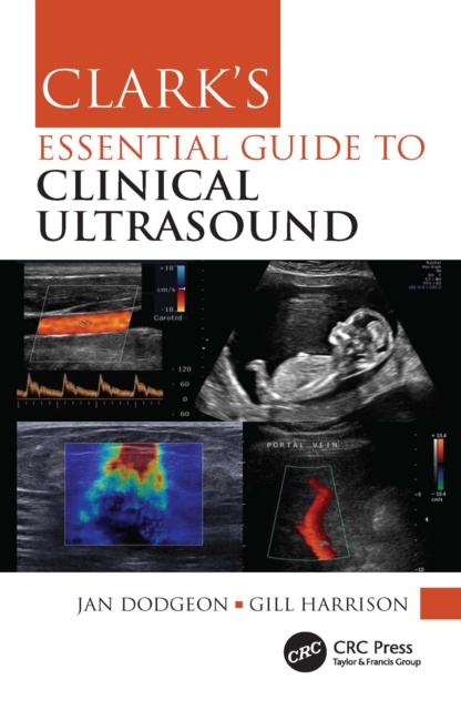 E-Book Clark's Essential Guide to Clinical Ultrasound Jan Dodgeon