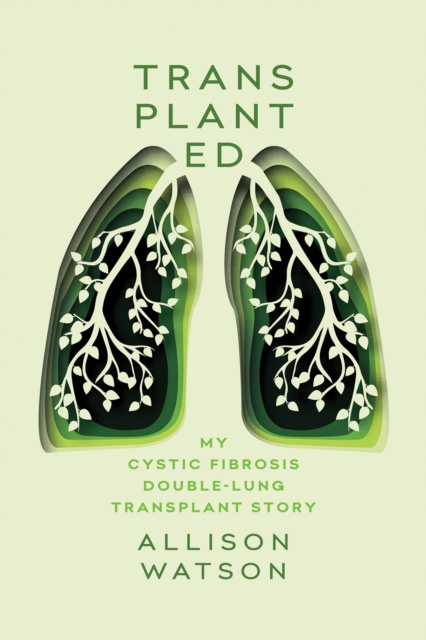 E-knjiga Transplanted Allison Watson