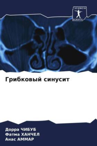 Libro Gribkowyj sinusit Fatma HANChEL