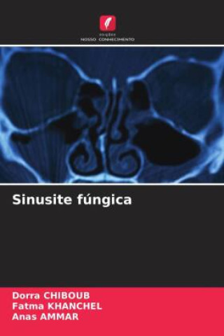 Buch Sinusite fúngica Fatma Khanchel