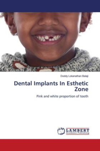 Könyv Dental Implants In Esthetic Zone 