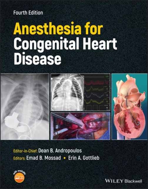 E-kniha Anesthesia for Congenital Heart Disease Dean B. Andropoulos