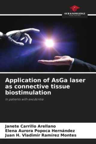 Knjiga Application of AsGa laser as connective tissue biostimulation Janete Carrillo Arellano