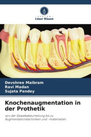 Kniha Knochenaugmentation in der Prothetik Devshree Maibram