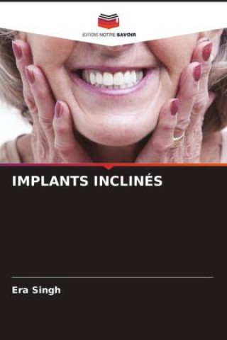 Kniha IMPLANTS INCLINÉS Era Singh
