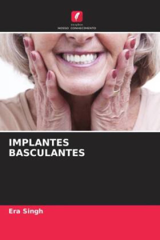 Knjiga IMPLANTES BASCULANTES Era Singh