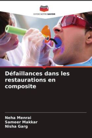 Knjiga Défaillances dans les restaurations en composite Neha Menrai