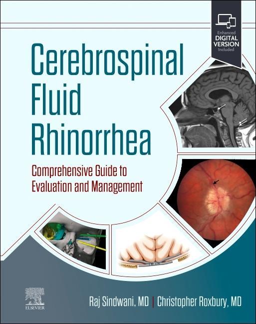 Książka Cerebrospinal Fluid Rhinorrhea Raj Sindwani