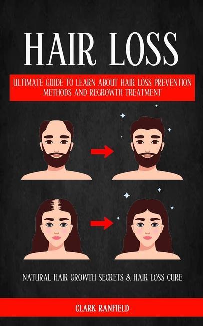 Kniha Hair Loss: Ultimate Guide To Learn About Hair Loss Prevention Methods And Regrowth Treatment (Natural Hair Growth Secrets & Hair 