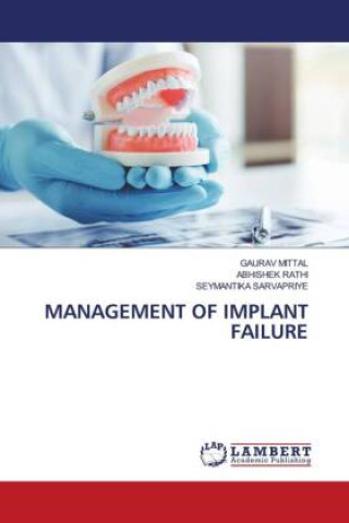 Knjiga MANAGEMENT OF IMPLANT FAILURE Abhishek Rathi
