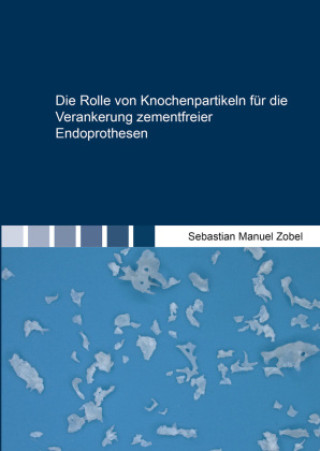 Книга Die Rolle von Knochenpartikeln für die Verankerung zementfreier Endoprothesen Sebastian Manuel Zobel