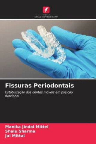 Carte Fissuras Periodontais Shalu Sharma