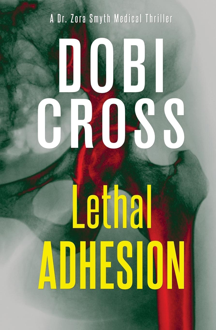 Knjiga Lethal Adhesion Dobi Cross
