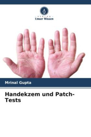 Buch Handekzem und Patch-Tests Mrinal Gupta