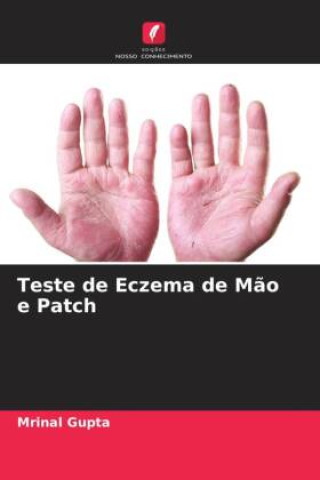 Book Teste de Eczema de M?o e Patch Mrinal Gupta
