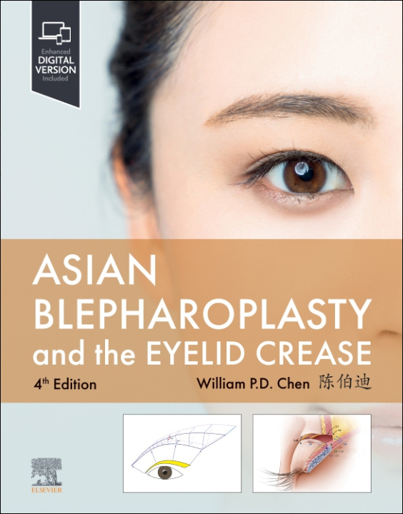 Kniha Asian Blepharoplasty and the Eyelid Crease William P. Chen