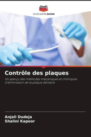 Knjiga Contrôle des plaques Shalini Kapoor