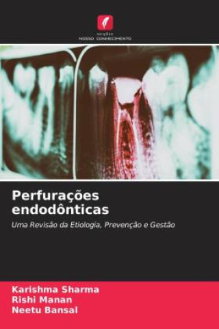 Książka Perfuraç?es endodônticas Rishi Manan