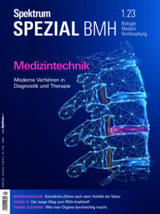 Kniha Spektrum Spezial - Medizintechnik Spektrum der Wissenschaft