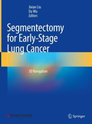 Carte Segmentectomy for Early-Stage Lung Cancer Jixian Liu