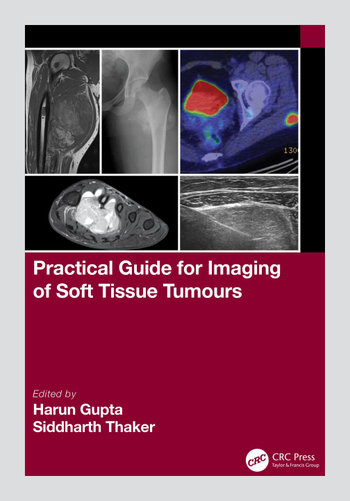 Książka Practical Guide for Imaging of Soft Tissue Tumours 